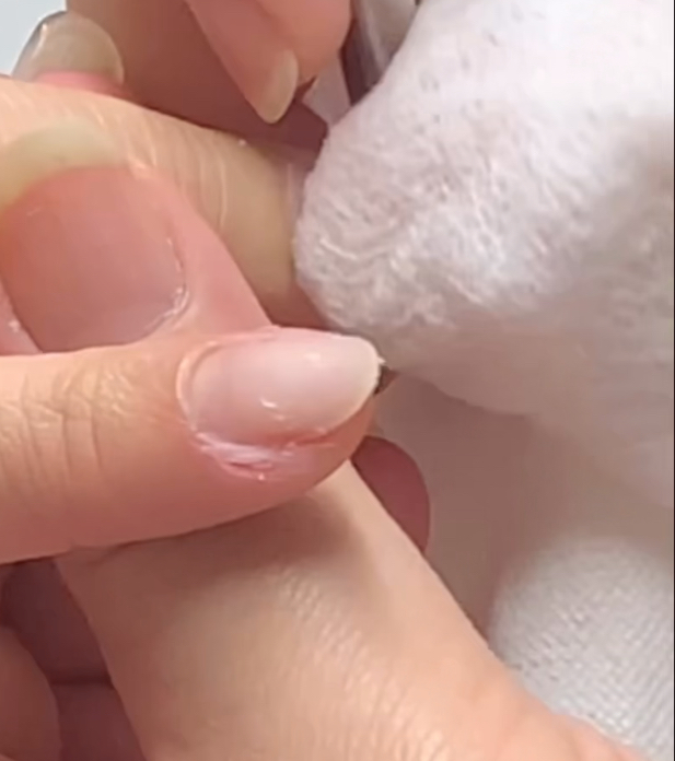 ネイルケアの様子