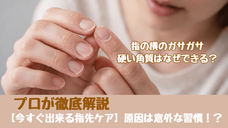 指の横のガサガサ・硬い角質を気にする女性