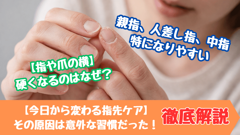 指先がガサガサで乾燥して悩む女性