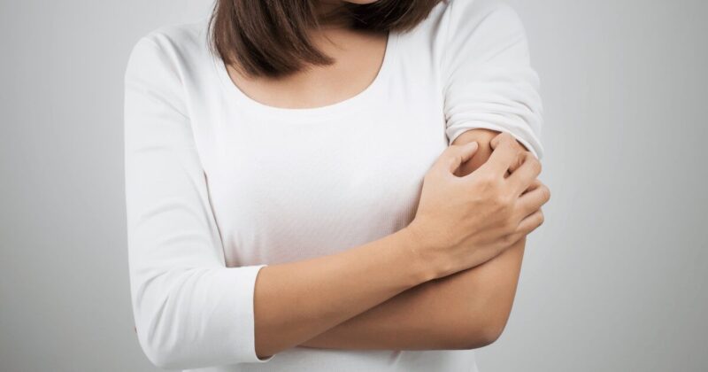 乾燥性湿疹で痒い女性