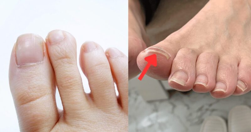 健康的な足の爪