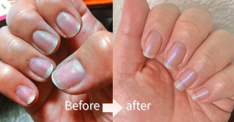 痛んだ爪のビフォーアフター