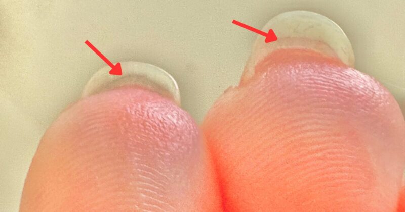 爪の裏にあるハイポニキウム