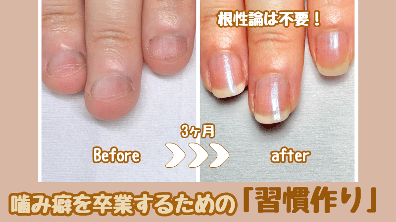 深爪から美爪になった変化画像