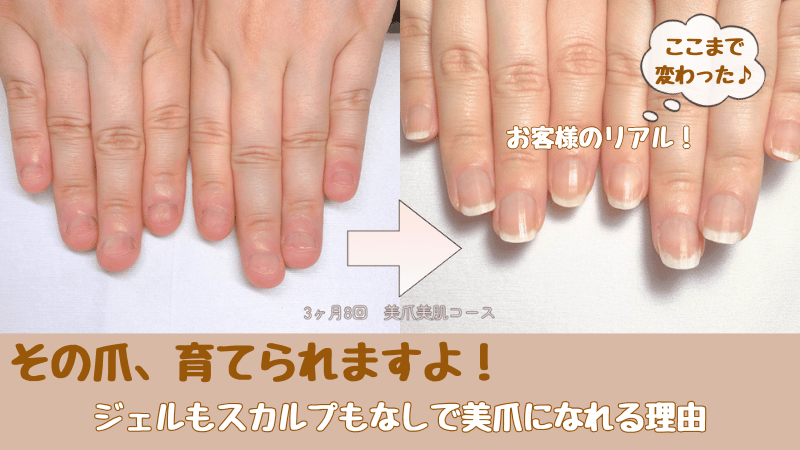 深爪から縦長の美爪になった人のBeforeAfter