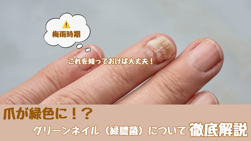 グリーンネイル