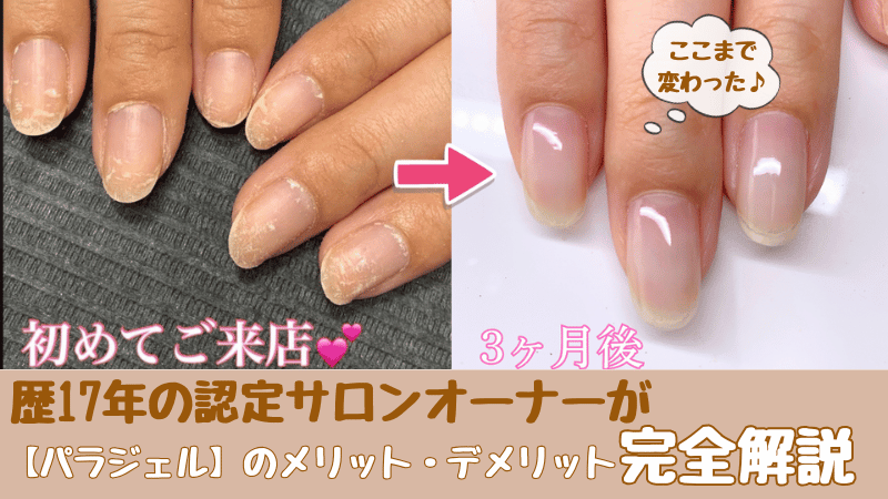 ボロボロの爪から健康になったBeforeAfter